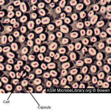 Bacterial Capsule: Importance, Capsulated Bacteria • Microbe Online