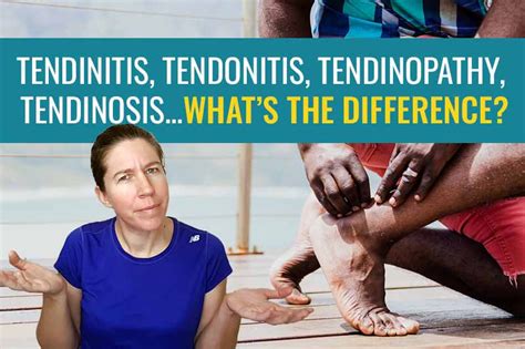 What’s the difference between Achilles tendonitis, tendinosis ...