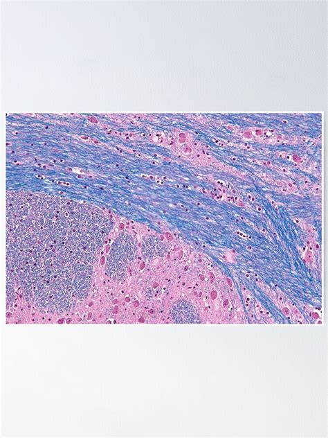 "Pons Histology" Poster by deltoid | Redbubble