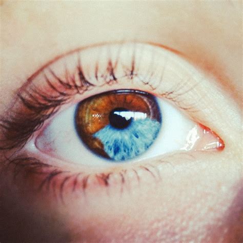 What is Heterochromia? | Futurism