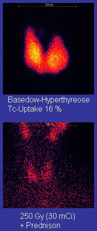 Technetium - Wikipedia