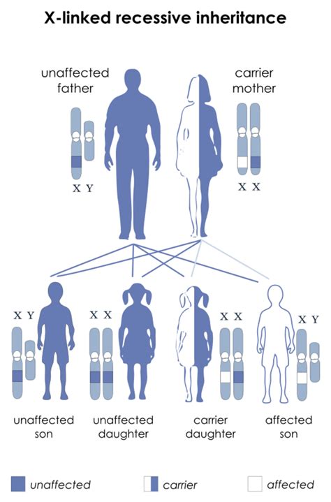 Medicine:Allan–Herndon–Dudley syndrome - HandWiki