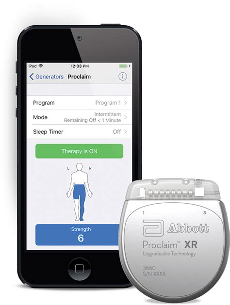 FDA Approves Abbott’s "Low Dose," Recharge-Free Spinal Cord Stimulation ...