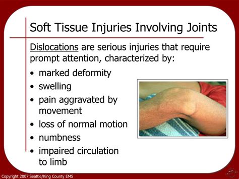 Ppt - Workplace Injuries Powerpoint Presentation, Free Download - Id AAE