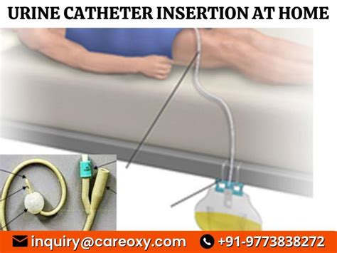 Urine Catheter Insertion At Home | Care Oxy Healthcare Services., Bangalore