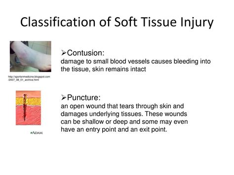 PPT - Soft Tissue Injury PowerPoint Presentation, free download - ID:1634436