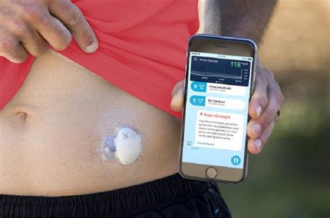 All About the Medtronic Guardian Connect Continuous Glucose Monitor (CGM) – Diabetes Daily