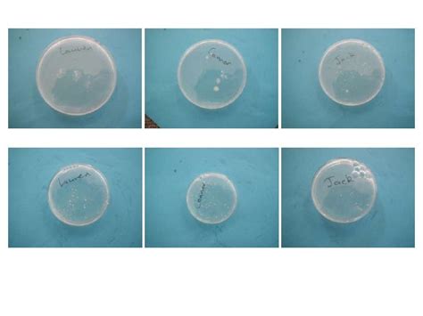 Agar plate results