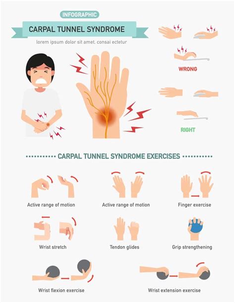 Carpal tunnel syndrome exercises - halfguide