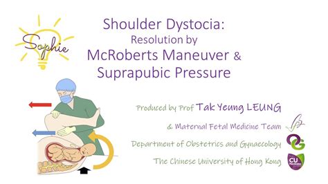 Mcroberts Maneuver Shoulder Dystocia