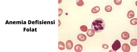 Anemia Defisiensi Folat - PT Indogen Intertama