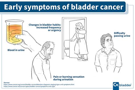 What Are the First Signs & Symptoms of Bladder Cancer?