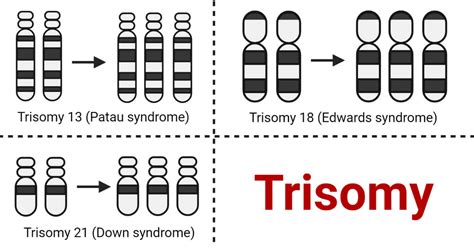 Trisomy- Definition, Causes, Types, Diagnosis, Treatments