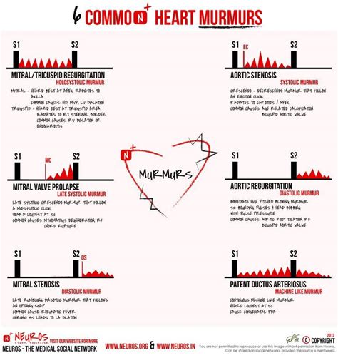 amudu: WHAT IS HEART MURMUR