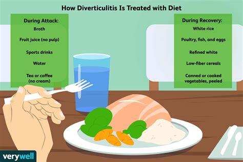 How To Avoid Diverticulitis » Kidnational