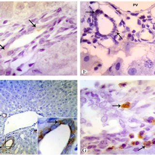 Photomicrograph of liver tissue in the control (a), liver injury (b),... | Download Scientific ...