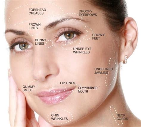 Botox Specialist - San Juan Capistrano, CA: HK Dermatology: Dermatology ...