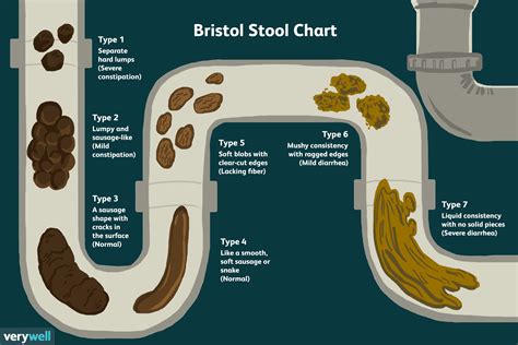 Bristol Stool Chart: Checking if Your Poop is Healthy