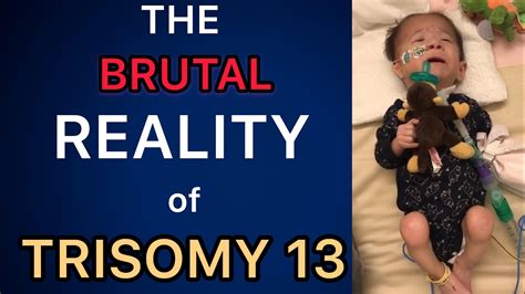 The BRUTAL Reality of Having a Trisomy Child (Trisomy 13 & 18) (13トリソミー) - YouTube