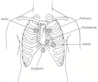 major precordial areas (will I ever feel comfortable doing these? :P) Nursing Notes, Nursing ...