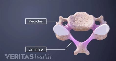 Pedicle Definition | Back Pain and Neck Pain Medical Glossary