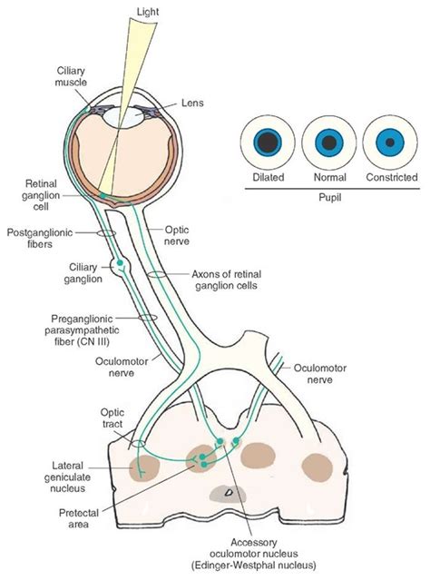 Pathophysiology of Pupillary Reflexes