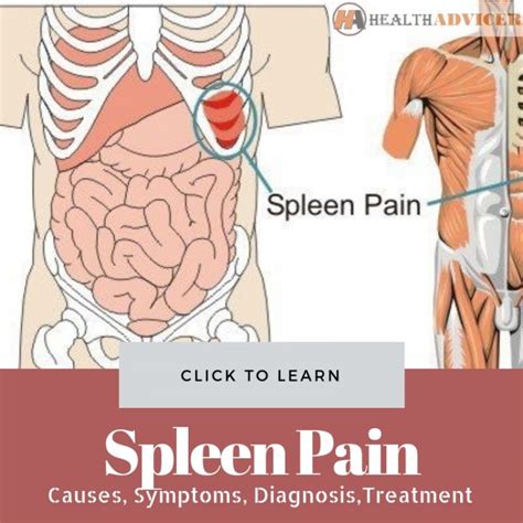 Spleen Pain Location | Hot Sex Picture