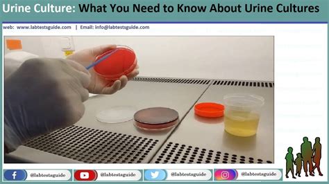 Urine Culture Procedure, Interpretation, Results and more | Lab Tests Guide