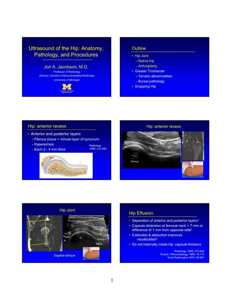 Ultrasound of the Hip: Anatomy, Pathology, and Procedures - DocsLib