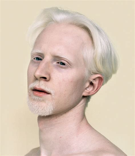 15+ Albino People Who’ll Mesmerize You With Their Otherworldly Beauty | Bored Panda