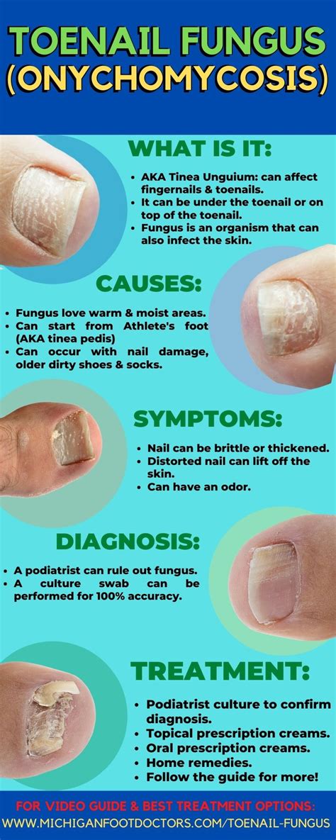 Terms Podiatrist Used to Describe Toenails