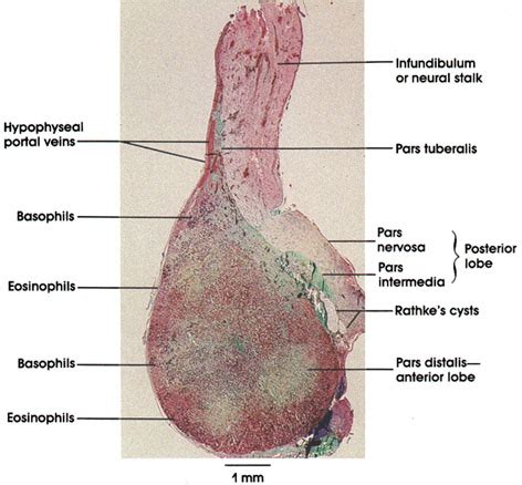 Plate 15.279 Hypophysis