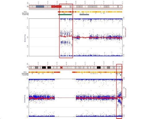 SNP microarray analysis of bone marrow sample of patient at diagnosis.... | Download Scientific ...