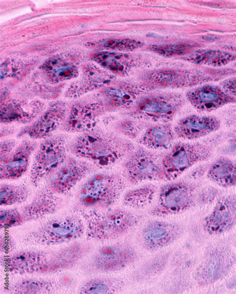 Epidermis. Stratum granulosum Stock Photo | Adobe Stock