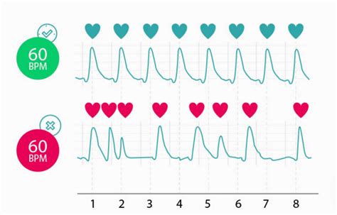 Heart rate versus heart rhythm - FibriCheck