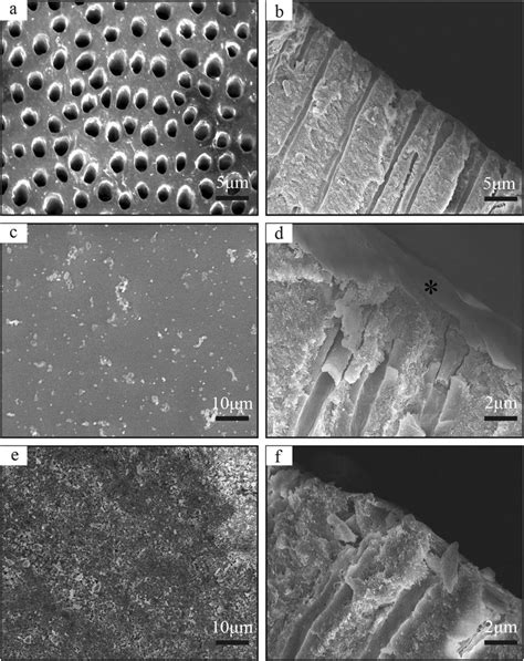 SEM photographs showing the morphologies of the exposed dentinal... | Download Scientific Diagram