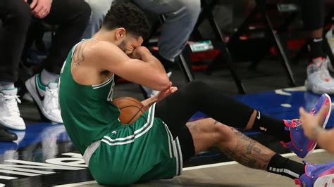 Jayson Tatum Injury Update: Celtics Star’s Eye Is ‘Red’ and ‘Swollen’ – NECN