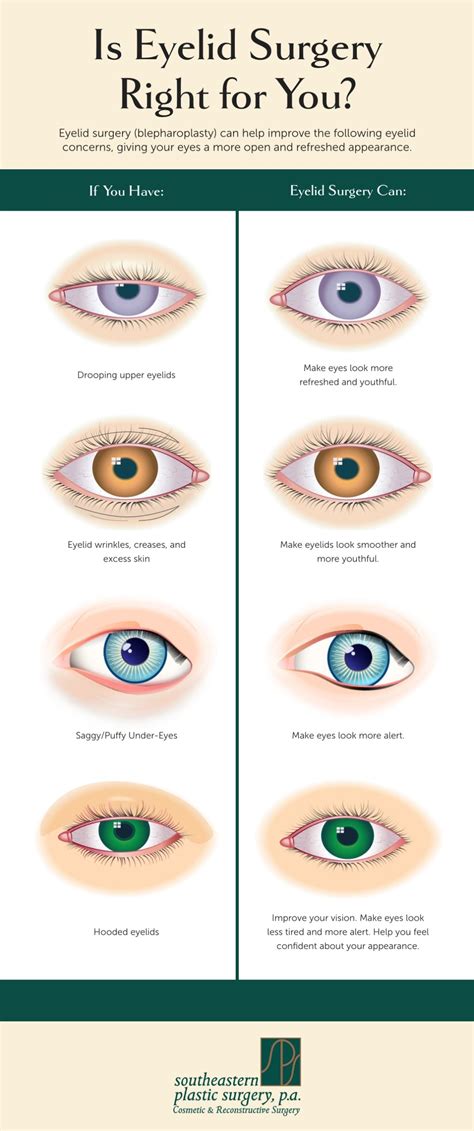 What Is the Best Treatment for Hooded Eyelids & Other Eyelid Issues? (Infographic ...