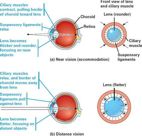 Miosis definition, causes, symptoms, diagnosis & treatment