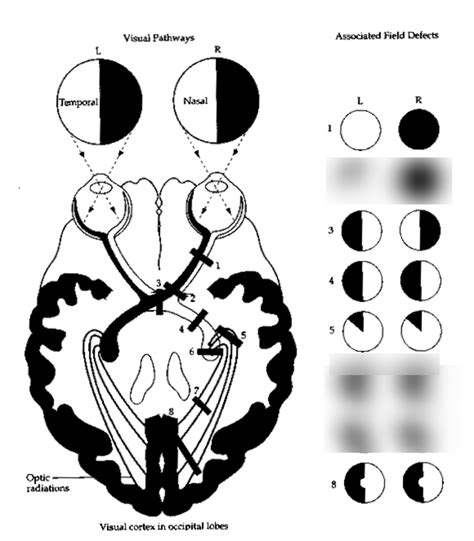 Visual Pathway Diagram | Quizlet