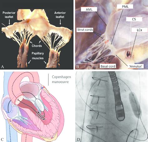 —subvalvular apparatus. a) anatomical specimen of human mitral valve ...