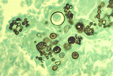 Dimorphic Fungi | Biology Dictionary