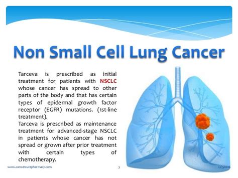 Non small cell lung cancer-Pancreatic cancer Treatment Medicine