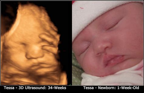 Cute Ultrasound Pics - Page 11 - BabyCenter