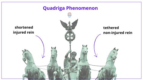 Quadriga Phenomenon