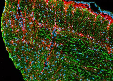 Brain Tissue Labeled with Alexa Fluor 488, Alexa Fluor 568, and Hoechst ...