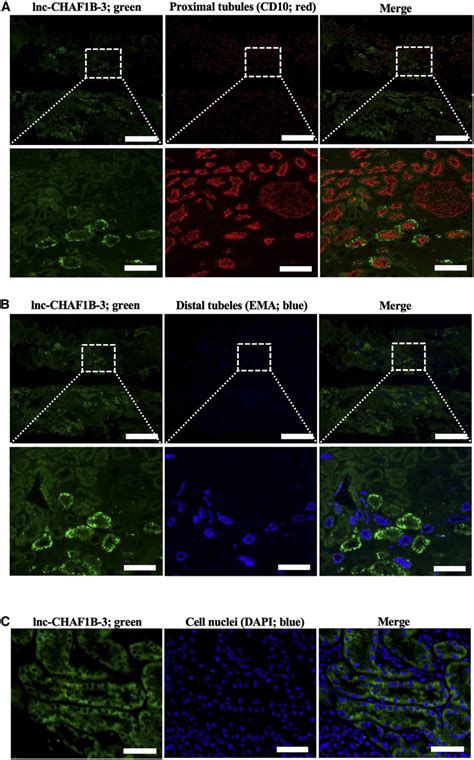 RNAscope FISH and immunofluorescence analysis of renal tissue of IgA... | Download Scientific ...