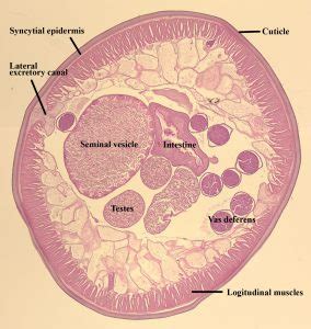 Ascaris lumbricoides – Male Cross Section – Parasitology