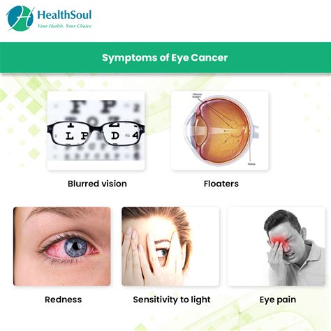 Blurred Vision Cancer Symptoms at Kevin Leonard blog