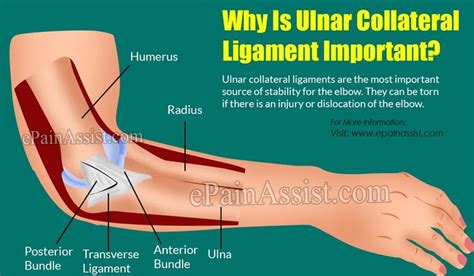 How Is Tommy John Surgery Done & What Is Its Recovery Period? Read:- https://www.epainassist.com ...